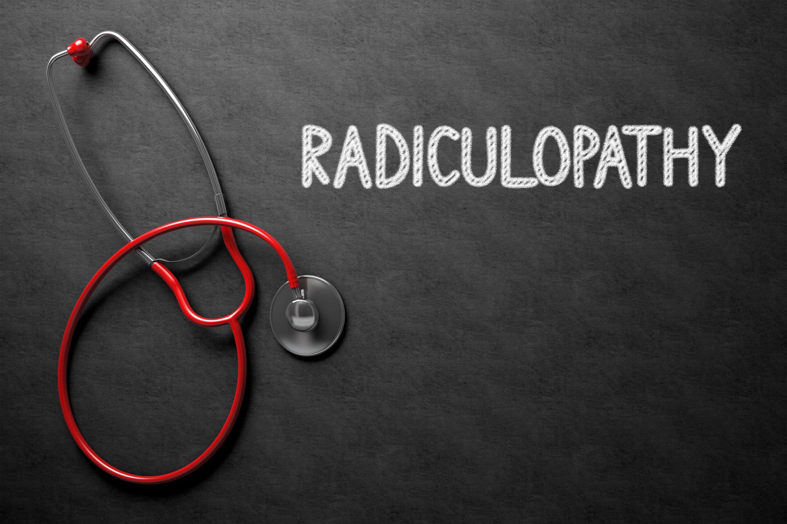 Can I get Social Security Disability for my radiculopathy?