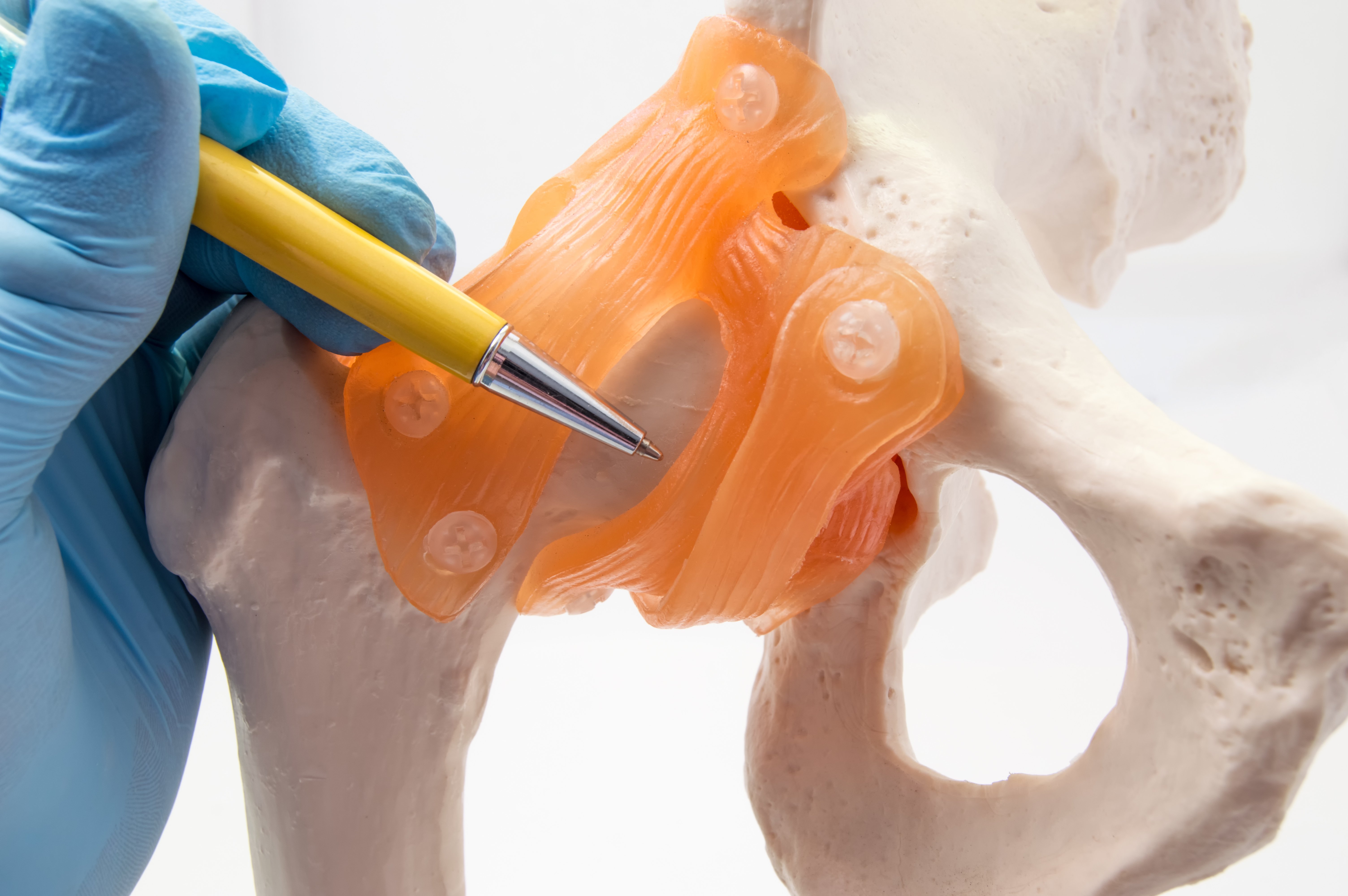 Can I get Social Security Disability for my hip dysplasia?