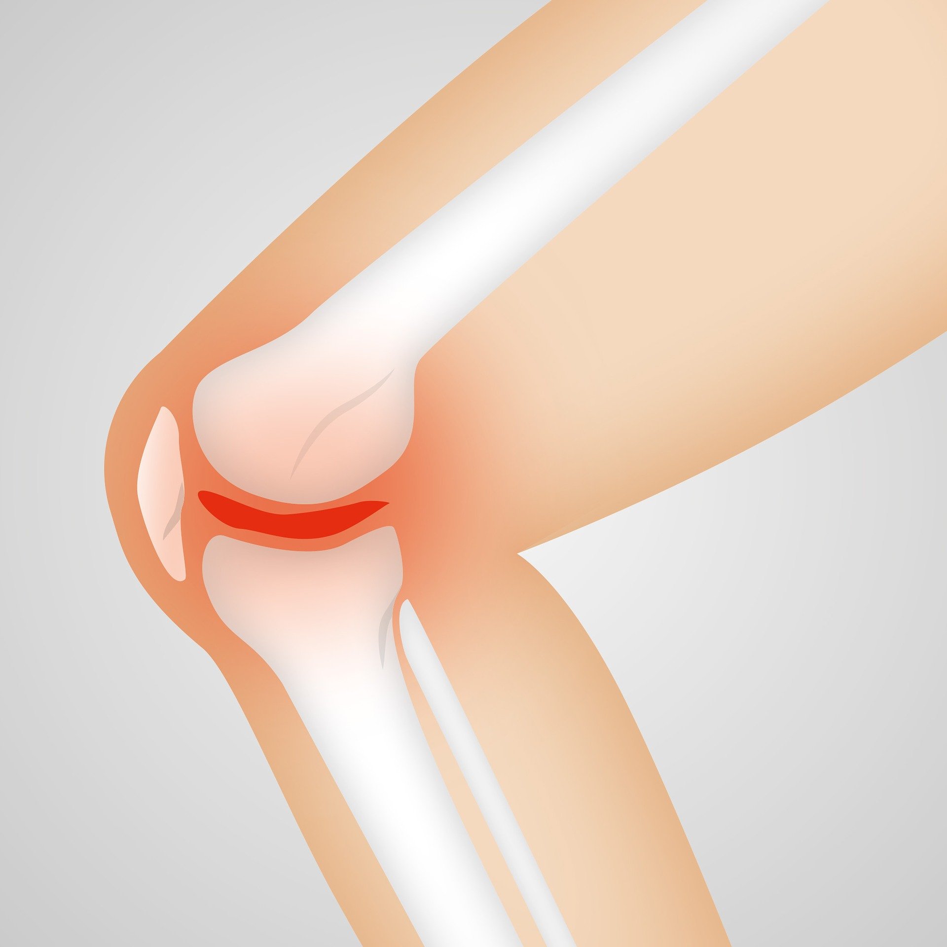 Can I get Social Security Disability for my torn meniscus?