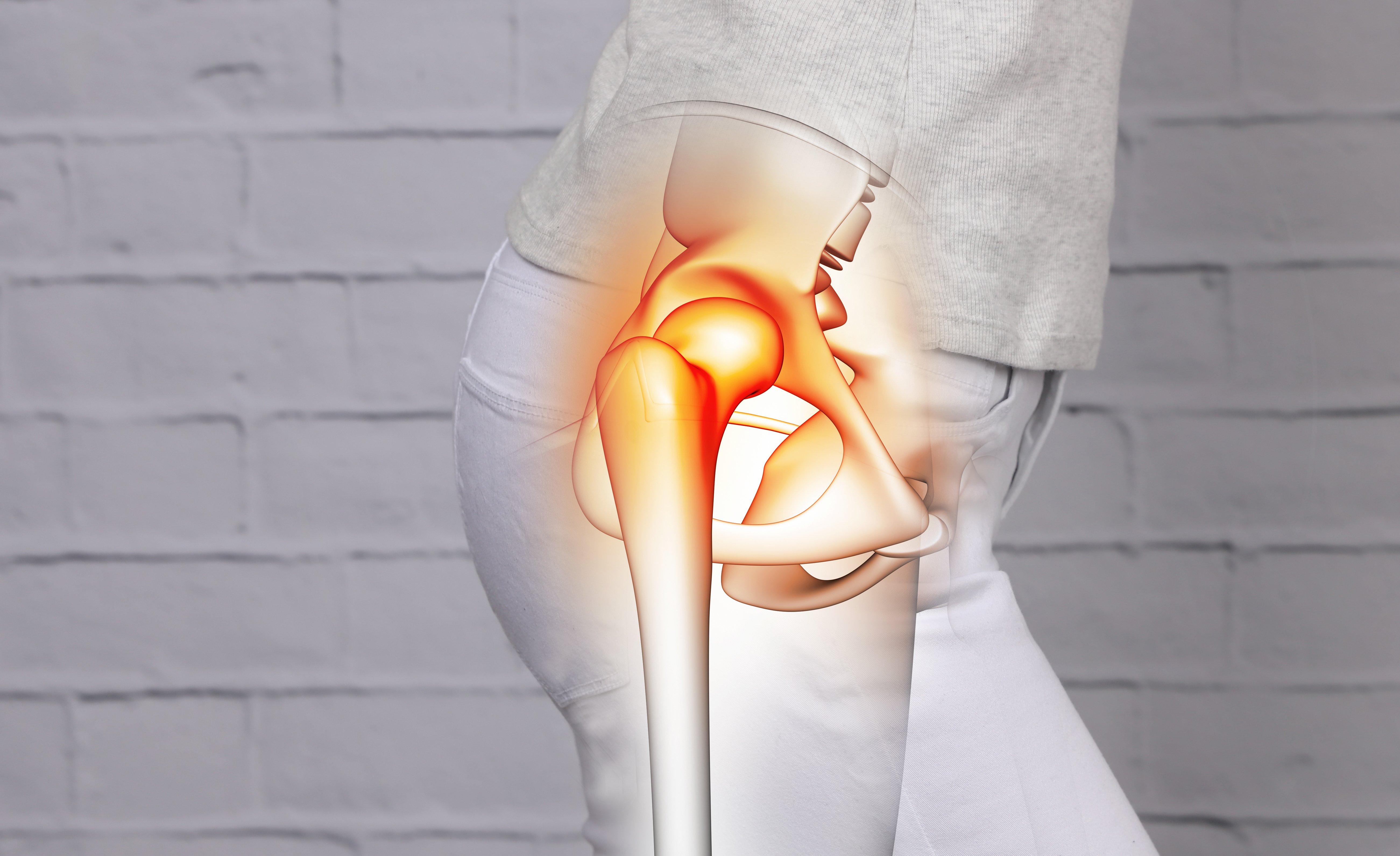 Can I get Social Security Disability for my hip pain?