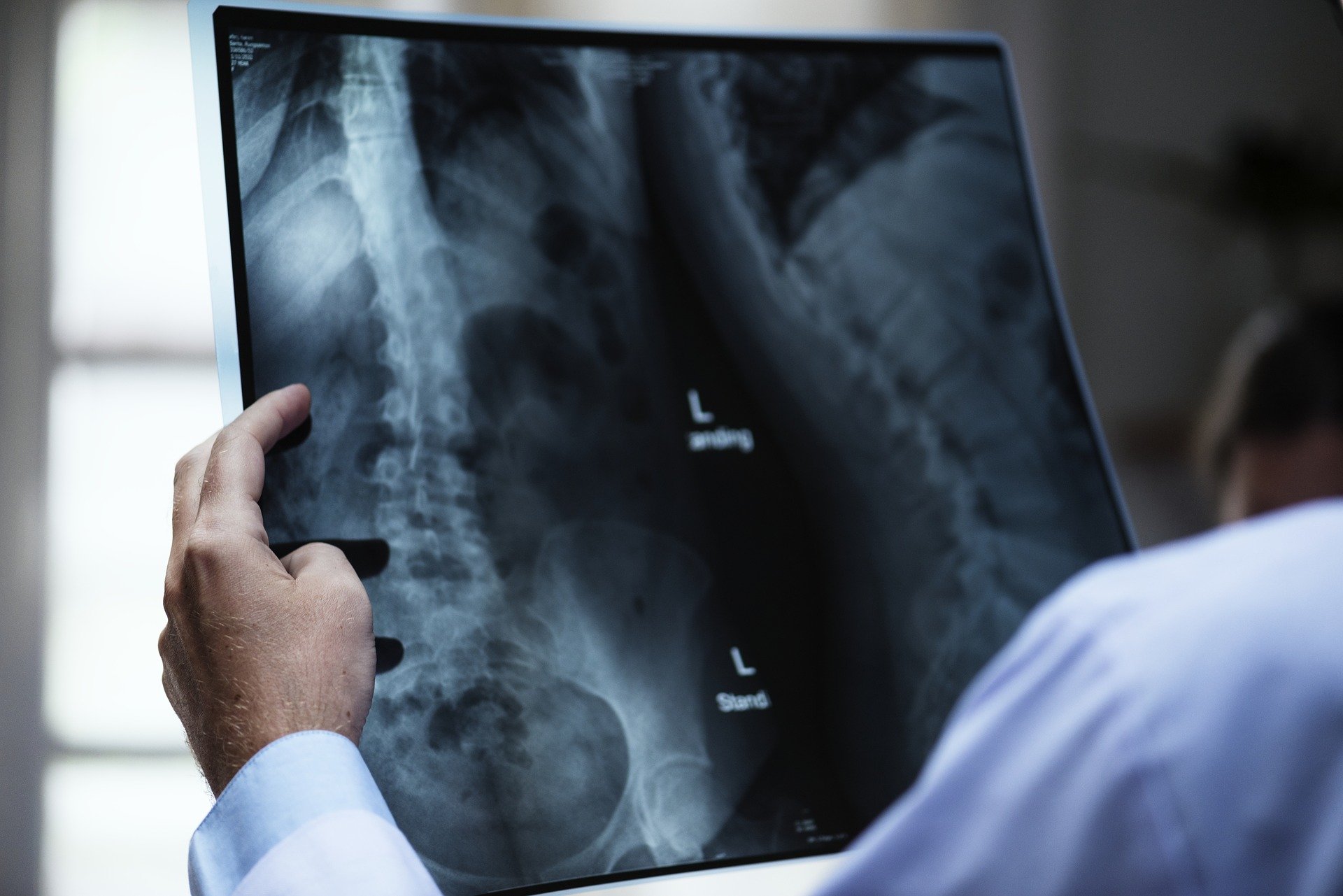 Can I get Social Security Disability for my spinal stenosis?