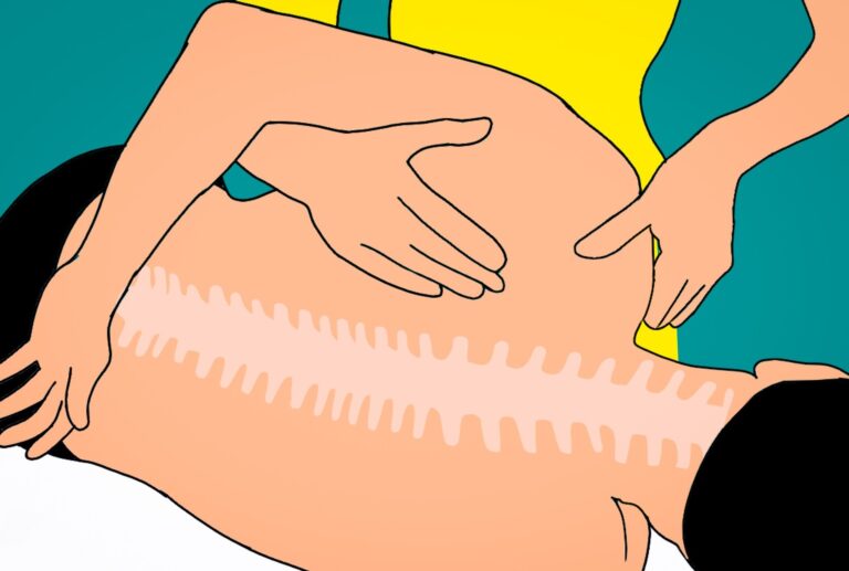 Can I get Social Security Disability for Back Pain?