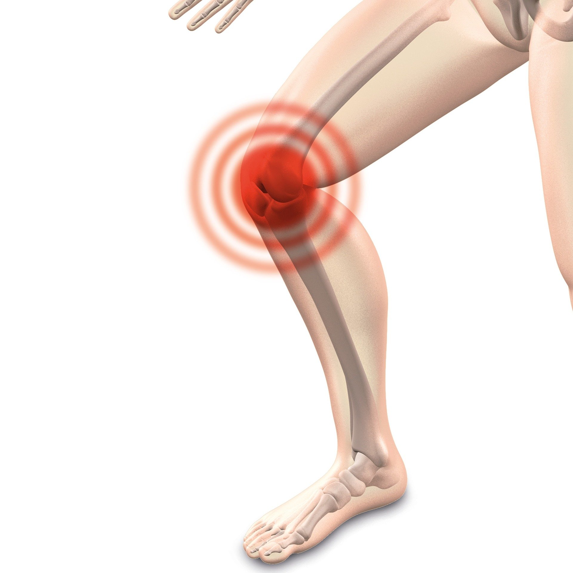 Can I get Social Security Disability for my patellar tendinitis?